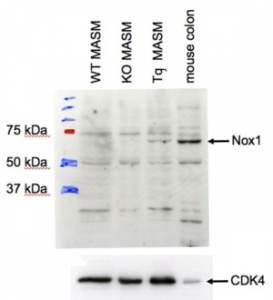 Western blot testing of transgenic mouse aortic smooth muscle (MASM) cell lysate with NOX1 antibody at 1ug/ml (CDK4 Ab used as a loading control).