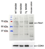 Western blot testing of transgenic mouse aortic smooth muscle cell (MASM) lysate with NOX1 antibody at 1ug/ml (CDK4 Ab used as a loading control).