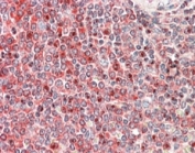 IHC staining of FFPE human spleen with PRKCB antibody at 5ug/ml. HIER: steamed with pH6 citrate buffer, AP-staining.