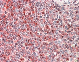 IHC staining of FFPE human spleen with PRKCB antibody at 5ug/ml. HIER: steamed with pH6 citrate