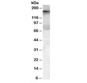 Western blot testing of HeLa lysate with GEF5 antibody at 0.1ug/ml. Predicted molecular weight: ~177kDa.~