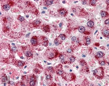 IHC staining of FFPE human liver with Catalase antibody at 2ug/ml. HIER: steamed with pH6 citrate buffer, AP-staining.
