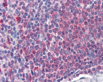 IHC staining of FFPE human spleen with Catalase antibody at 2ug/ml. HIER: steamed with pH6 citrate buffer, AP-staining.