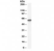 Western blot testing of human kidney lysate with Catalase antibody at 1ug/ml. Predicted molecular weight ~60 kDa.