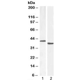 Western blot testing of 1) mouse spleen lysate at 1ug/ml and 2) rat spleen lysate at 0.3ug/ml with PAX5 antibody. Predicted