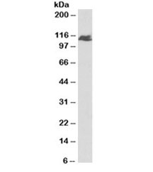 Western blot testing of human liver lysate with BMPR2 antibody at 1ug/ml. Predicted molecular weight ~115kDa.