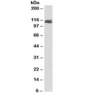 Western blot testing of human liver lysate with BMPR2 antibody at 1ug/ml. Predicted molecular weight ~115 kDa (precursor).
