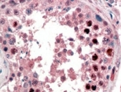 IHC staining of FFPE human testis with NANOG antibody at 2ug/ml. HIER: steamed with pH6 citrate buffer, AP-staining.