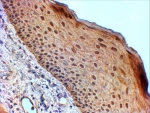 IHC staining of FFPE human skin with 14-3-3 sigma antibody at 2ug/ml. HIER: steamed with pH9 Tris/EDTA buffer, HRP-staining.