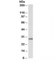 Western blot testing of human skin lysate with 14-3-3 sigma antibody at 0.03ug/ml. Predicted molecular weight: ~28kDa.