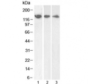 Western blot testing of human 1) HeLa, 2) HepG2 and 3) Jurkat cell lysate with DDB1 antibody at 1ug/ml. Predicted molecular weight: ~127 kDa.