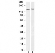 Western blot testing of mouse 1) NIH3T3 and 2) NSO lysate with DDB1 antibody at 0.01ug/ml. Predicted molecular weight: ~127 kDa.