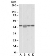 Western blot testing of Daudi [A], Jurkat [B], K562 [C] and MOLT4 [D] lysates with MAP2K2 antibody at 0.3ug/ml. Predicted molecular weight: ~45kDa.