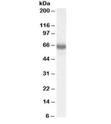 Western blot testing of MOLT4 lysate with IKAROS antibody at 0.03ug/ml. Predicted molecular weight ~58kDa but routinely observed at ~65kDa.