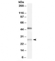 Western blot testing of human kidney lysate with BNIP1 antibody at 0.5ug/ml. Predicted molecular weight: ~26kDa. Both bands are both blocked by the immunizing peptide.