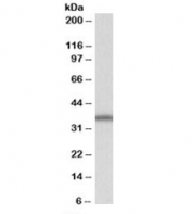 Western blot testing of Daudi lysate with SLC9A3R2 antibody at 1ug/ml. Predicted molecular weight: ~36kDa.
