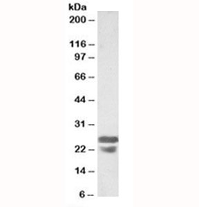 Western blot testing of mouse spleen lysates with ASC antibody at 0.5ug/ml. Predicted molecular weight ~22kDa.