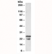 Western blot testing of mouse spleen lysates with ASC antibody at 0.5ug/ml. Predicted molecular weight ~22 kDa.