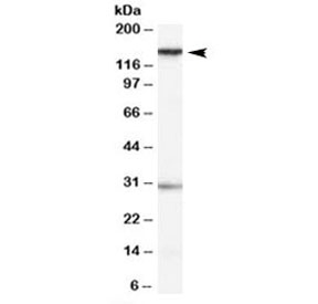 Western blot testing of HeLa cell lysate with SUPT16H antibody at 0.1ug/ml. Predicted molecular weight: ~120kDa, routinely observed between 140~150kDa. Both observed bands are blocked by addition of immunizing peptide.