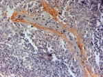IHC testing of FFPE human tonsil with NLRP3 antibody at 2ug/ml. HIER: steamed with pH6 citrate buffer, HRP-staining.