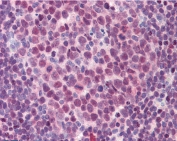 IHC testing of FFPE human colon (lymphoid aggregate) tissue with PU.1 antibody at 3.75ug/ml. Required HIER: steamed antigen retrieval with pH6 citrate buffer; AP-staining.