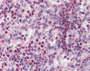 IHC testing of FFPE human spleen tissue with PU.1 antibody at 3.75ug/ml. Required HIER: steamed antigen retrieval with pH6 citrate buffer; AP-staining.