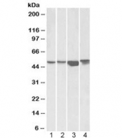 Western blot testing of human 1) HEK293, 2) A431, 3) HeLa and 4) Jurkat cell lysate with ILK antibody at 1ug/ml. Expected molecular weight: 51-59 kDa.