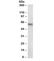 Western blot testing of human hippocampus lysate with GLAST antibody at 2ug/ml. Predicted molecular weight ~60kDa.