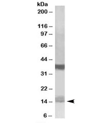 Western blot testing of K562 lysate with Prefoldin antibody at 1ug/ml. Predicted molecular weight: ~14kDa. Both observed bands are blocked by addition of immunizing peptide.