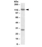 Western blot testing of MOLT4 lysate with UBN1 antibody at 1ug/ml. The expected ~120kDa band and the additional ~28kDa band are both blocked by the immunizing peptide.