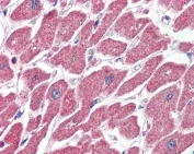 IHC staining of FFPE human heart with CPT1A antibody at 4ug/ml. HIER: steamed with pH6 citrate buffer, AP-staining.