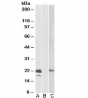 Western blot testing of HEK293 lysate overexpressing human CST8-MYC probed with Cystatin 8 antibody [0.3ug/ml] in Lane A and anti-MYC [1/1000] in lane C. Mock-transfected HEK294 probed with Cystatin 8 antibody [1ug/ml] in Lane B.