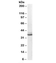 Western blot testing of human liver lysate with AKR1C4 antibody at 0.1ug/ml. Predicted molecular weight: ~37kDa.~