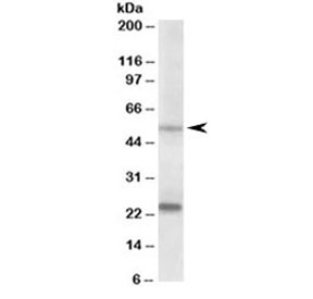 Western blot testing of prostate lysate with MMP3 antibody at 0.2ug/ml. Molecular weight: the expected ~54kDa band and the additional ~24kDa band are both blocked by the immunizing peptide.~