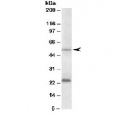 Western blot testing of human prostate lysate with MMP3 antibody at 0.2ug/ml. Molecular weight: the expected ~54 kDa band and the additional ~24kDa band are both blocked by the immunizing peptide.