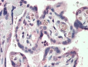 IHC testing of FFPE human placental tissue with SLC12A4 antibody at 5ug/ml. Steamed antigen retrieval with citrate buffer pH 6, AP-staining.