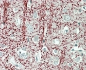 IHC staining of FFPE human cerebral cortex with TPPP antibody at 4ug/ml. HIER: steamed with pH6 citrate buffer, AP-staining.