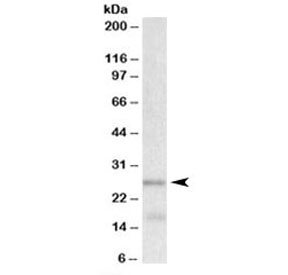 Western blot testing of human cerebellum lysate with TPPP antibody at 0.001ug/ml. Predicted molecular weight: ~24kDa.
