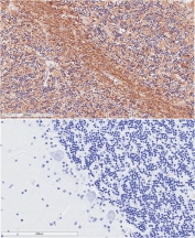 IHC staining of FFPE human cerebellum with (top) and without (bottom) TPPP antibody at 2ug/ml. HIER: steamed with pH6 citrate buffer, HRP-staining.
