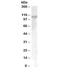 Western blot testing of rat kidney lysate with IL17ra antibody at 1ug/ml. Predicted molecular weight: ~97kDa, observed here at ~110kDa.