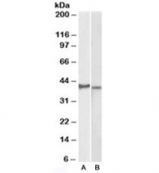 Western blot testing of KELLY [A] and U251-MG [B] lysates with CX3CR1 antibody at 2ug/ml. Predicted molecular weight ~40kDa.