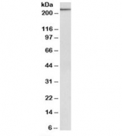 Western blot testing of NIH3T3 lysate with MYH9 antibody at 1ug/ml. Predicted molecular weight: ~227kDa.