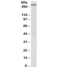 Western blot testing of NIH3T3 lysate with MYH9 antibody at 1ug/ml. Predicted molecular weight: ~227