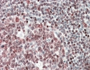 IHC staining of FFPE human human tonsil with Fubp1 antibody at 5ug/ml. HIER: steamed with pH6 citrate buffer, AP-staining.
