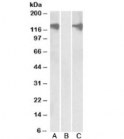 Western blot testing of HEK293 lysate overexpressing human PUM2-FLAG with PUM2 antibody (0.5ug/ml) in Lane A and probed with anti-FLAG (1/3000) in lane C. Mock-transfected HEK293 probed with PUM2 antibody (1ug/ml) in Lane B.