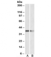 Western blot of mouse (A) and rat (B) brain lysates with PRMT2 antibody at 2ug/ml. Predicted molecular weight: ~37kDa.