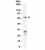 Western blot testing of rat testis lysate with Sall4 antibody at 0.1ug/ml. Predicted molecular weight ~110/68kDa (Isoforms a/b). All three bands are blocked by the immunizing peptide.