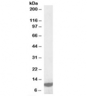 Western blot testing of K562 lysate with LSM2 antibody at 1ug/ml. Predicted molecular weight: ~10kDa.