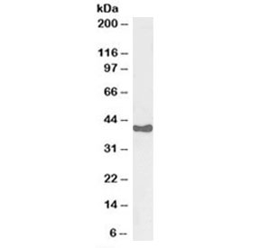 Western blot testing of human adrenal gland lysate with HSD3B1 antibody at 0.003ug/ml. Predicted molecular weight: ~42 kDa.
