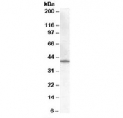 Western blot testing of human placenta lysate with HSD3B1 antibody at 0.01ug/ml. Predicted molecular weight: ~42 kDa.